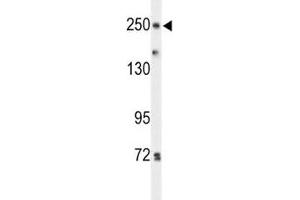 Western blot analysis of PTPRD antibody and HeLa lysate. (PTPRD 抗体  (AA 343-371))
