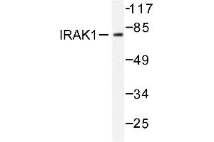 Image no. 1 for anti-Interleukin-1 Receptor-Associated Kinase 1 (IRAK1) antibody (ABIN272026) (IRAK1 抗体)