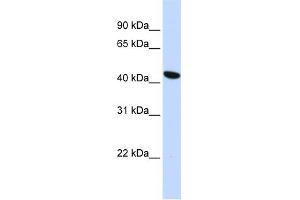 WB Suggested Anti-TMEM117 Antibody Titration:  0. (TMEM117 抗体  (Middle Region))