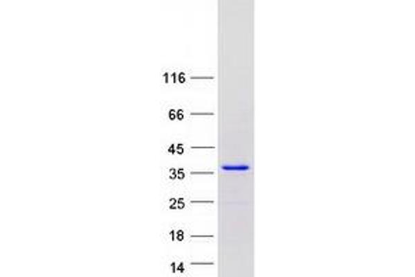 SETBP1 Protein (Transcript Variant 2) (Myc-DYKDDDDK Tag)