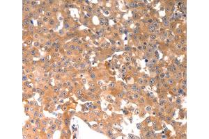 Immunohistochemistry (IHC) image for anti-Osteocalcin (BGLAP) antibody (ABIN2425623) (Osteocalcin 抗体)