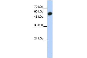 WB Suggested Anti-LRRC6 Antibody Titration: 0. (LRRC6 抗体  (Middle Region))