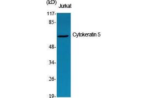 Western Blot (WB) analysis of specific cells using Cytokeratin 5 Polyclonal Antibody. (Cytokeratin 5 抗体  (C-Term))