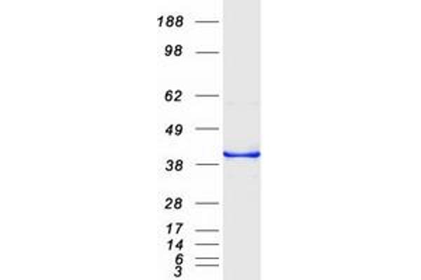 CDCA3 Protein (Myc-DYKDDDDK Tag)