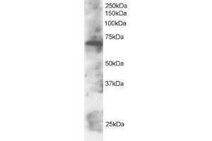 Western Blotting (WB) image for anti-SWAP Switching B-Cell Complex 70kDa Subunit (SWAP70) (C-Term) antibody (ABIN2466338) (SWAP70 抗体  (C-Term))