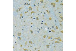 Immunohistochemistry of paraffin-embedded mouse brain using RPS7 antibody (ABIN5974069) at dilution of 1/100 (40x lens). (RPS7 抗体)