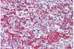 Human Thymus (formalin-fixed, paraffin-embedded) stained with TIMD4 antibody ABIN213994 at 5 ug/ml followed by biotinylated goat anti-rabbit IgG secondary antibody ABIN481713, alkaline phosphatase-streptavidin and chromogen. (TIMD4 抗体  (Internal Region))