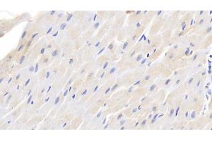 Detection of TGFb1 in Canine Cardiac Muscle Tissue using Polyclonal Antibody to Transforming Growth Factor Beta 1 (TGFb1) (TGFB1 抗体  (AA 279-390))