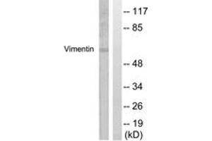 Western Blotting (WB) image for anti-Vimentin (VIM) (AA 31-80) antibody (ABIN2888938) (Vimentin 抗体  (AA 31-80))