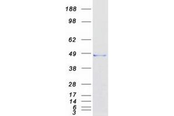 ARMC8 Protein (Transcript Variant 1) (Myc-DYKDDDDK Tag)