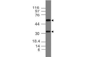 Image no. 1 for anti-Tumor Necrosis Factor (Ligand) Superfamily, Member 11 (TNFSF11) antibody (ABIN5027776) (RANKL 抗体)