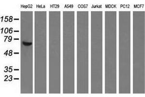 Western blot analysis of extracts (35 µg) from 9 different cell lines by using anti-AFP monoclonal antibody. (alpha Fetoprotein 抗体)