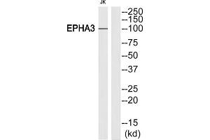 Western blot analysis of extracts from Jurkat cells, using EPHA3 (epitope around residue 602) antibody. (EPH Receptor A3 抗体)