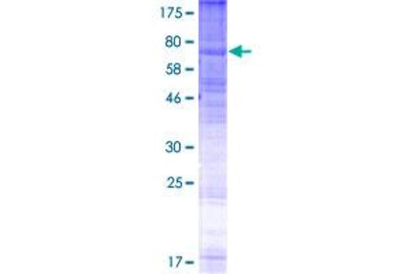 GPR143 Protein (AA 1-424) (GST tag)