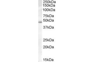 Western Blotting (WB) image for anti-DKFZp686H10114 (Middle Region) antibody (ABIN2779749) (DKFZp686H10114 (Middle Region) 抗体)