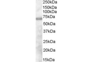 Western Blotting (WB) image for anti-Differentially Expressed in FDCP 6 Homolog (DEF6) (N-Term) antibody (ABIN2465595) (DEF6 抗体  (N-Term))