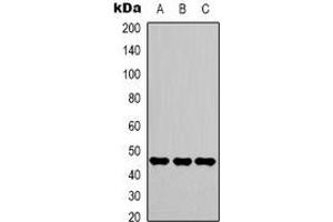 Western blot analysis of Gamma-enolase expression in Hela (A), Jurkat (B), 293T (C) whole cell lysates. (ENO2/NSE 抗体)