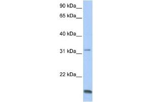 TCAP antibody used at 1 ug/ml to detect target protein. (TCAP 抗体)