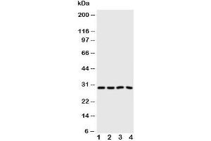 Western blot testing of Carbonic Anhydrase III antibody and Lane 1:  SMMC-7721;  2: HeLa;  3: SW620;  4: SCG cell lysate (CA3 抗体  (N-Term))