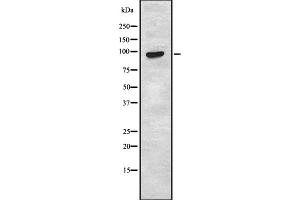 Western blot analysis TAS1R2 using HUVEC whole cell lysates. (TAS1R2 抗体)