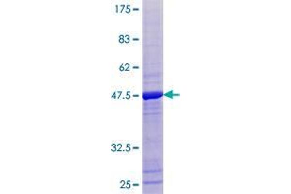 TPRKB Protein (AA 1-175) (GST tag)