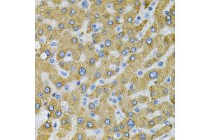Immunohistochemistry of paraffin-embedded human liver injury using SDC4 Antibody (ABIN1874710) at dilution of 1:100 (40x lens). (SDC4 抗体)