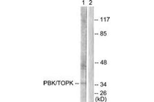 Western Blotting (WB) image for anti-PDZ Binding Kinase (PBK) (AA 1-50) antibody (ABIN2879108) (PBK 抗体  (AA 1-50))