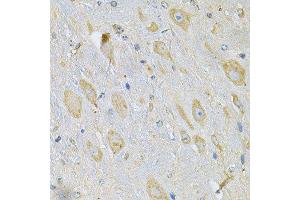 Immunohistochemistry of paraffin-embedded mouse brain using TXNDC5 Antibody. (TXNDC5 抗体  (AA 1-324))