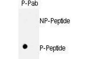 Image no. 1 for anti-Retinoblastoma 1 (RB1) (pSer811) antibody (ABIN358217) (Retinoblastoma 1 抗体  (pSer811))