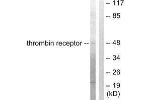 Western Blotting (WB) image for anti-Coagulation Factor II (thrombin) Receptor (F2R) (N-Term) antibody (ABIN1848803) (PAR1 抗体  (N-Term))