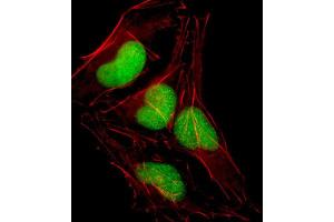 Immunofluorescence (IF) image for anti-SRY (Sex Determining Region Y)-Box 18 (SOX18) antibody (ABIN2998551) (SOX18 抗体)