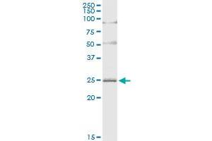 Immunoprecipitation of ARL4D transfected lysate using rabbit polyclonal anti-ARL4D and Protein A Magnetic Bead (ARL4D (人) IP-WB Antibody Pair)