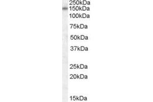 Western Blotting (WB) image for anti-Discs, Large Homolog 1 (DLG1) (AA 661-673) antibody (ABIN342982) (DLG1 抗体  (AA 661-673))