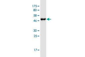 Western Blot detection against Immunogen (46. (PTK2B 抗体  (AA 682-871))