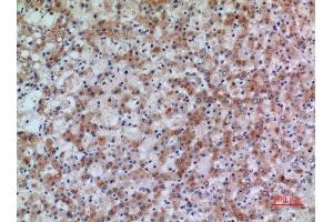 Immunohistochemistry (IHC) analysis of paraffin-embedded Human Liver, antibody was diluted at 1:100. (17beta-HSD4 (N-Term) 抗体)
