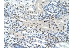 Semenogelin I antibody was used for immunohistochemistry at a concentration of 4-8 ug/ml to stain Epithelial cells of renal tubule (arrows) in Human Kidney. (SEMG1 抗体  (N-Term))