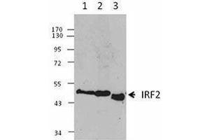 Western Blotting (WB) image for anti-Interferon Regulatory Factor 2 (IRF2) antibody (ABIN2665203) (IRF2 抗体)
