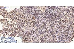 Immunohistochemistry of paraffin-embedded Mouse lung tissue using CD10 Monoclonal Antibody at dilution of 1:200. (MME 抗体)