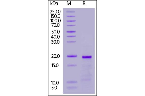 Topoisomerase II alpha Protein (AA 1354-1473)