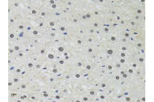 Immunohistochemistry of paraffin-embedded rat liver using PPP4C antibody (ABIN5971135) at dilution of 1/100 (40x lens). (PPP4C 抗体)