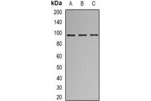 Western blot analysis of Nibrin expression in HEK293T (A), A549 (B), Jurkat (C) whole cell lysates. (Nibrin 抗体)