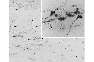 AP32076PU-N AGRP Antibody staining of PFA-perfused cryosection of Human Hypothalamus at 0. (AGRP 抗体  (C-Term))