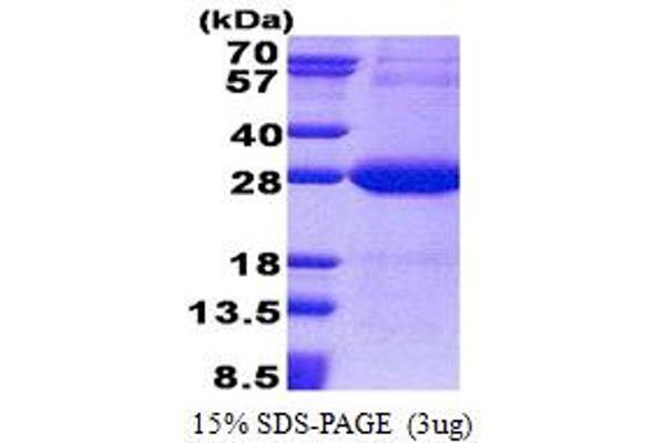 NDUFV2 Protein (AA 33-249) (His tag)