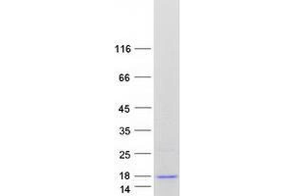 ZNF706 Protein (Transcript Variant 3) (Myc-DYKDDDDK Tag)