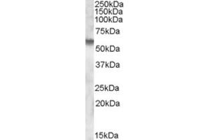 Western Blotting (WB) image for anti-Iduronate 2-Sulfatase (IDS) (Internal Region) antibody (ABIN2466805) (IDS 抗体  (Internal Region))