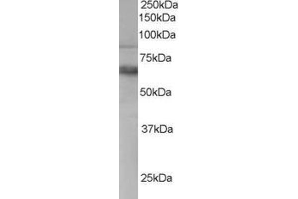 ANTXR1 抗体  (C-Term)