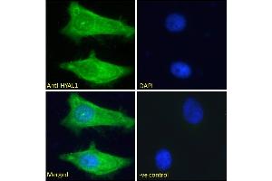 ABIN334421 Immunofluorescence analysis of paraformaldehyde fixed HeLa cells, permeabilized with 0. (HYAL1 抗体  (Internal Region))