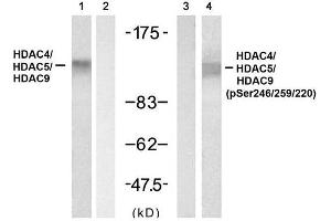 Western blot analysis of extracts from 3T3 cell using HDAC4/ HDAC5/HDAC9 (Ab-246/259/220) Antibody (E021517, Lane 1 and 2) and HDAC4/ HDAC5/HDAC9 (phospho- Ser246/ 259/ 220) Antibody (E011517, Lane 3 and 4). (HDAC4/HDAC5/HDAC9 抗体)