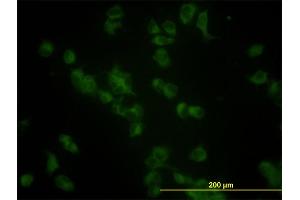 Immunofluorescence (IF) image for anti-Glucosidase, Beta, Acid (GBA) (AA 146-235) antibody (ABIN561009)