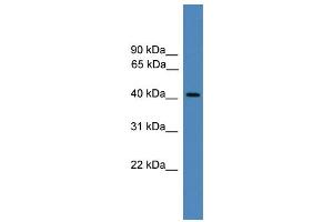 WB Suggested Anti-PSMC6 Antibody Titration: 0. (PSMC6 抗体  (C-Term))